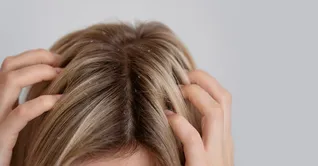 با موهای کراتین شده ولی شوره دار چه کنم؟