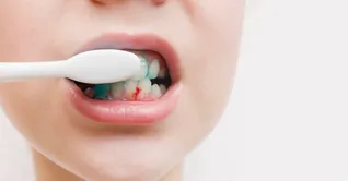 دلیل خونریزی لثه هنگام مسواک زدن چیست؟