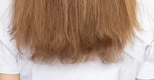 دلایل اصلی خشکی مو چیست و چگونه می‌توان آن را درمان کرد؟