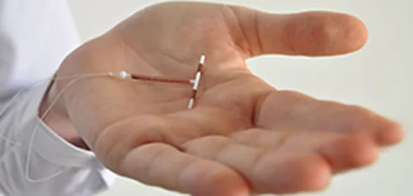 جلوگیری از بارداری با دستگاه داخل رحمی آی یو دی؛ انواع IUD، مزایا و معایب