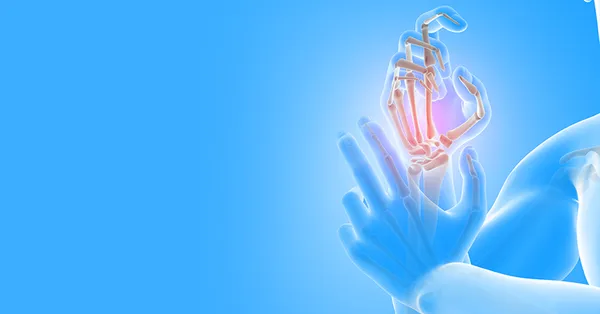 آرتریت پسوریاتیک؛ علائم، علل و روش‌های درمان